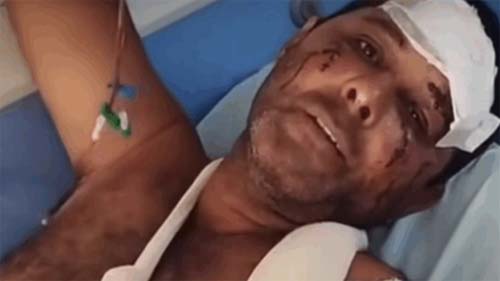 Homem de 51 anos é atacado por onça-pintada enquanto cavalgava em mata de Goiás