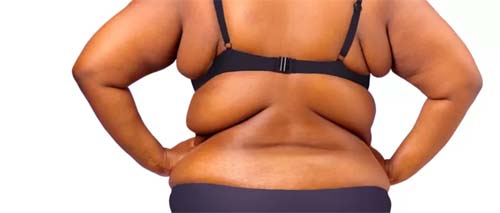 Como escravidão e racismo alimentaram gordofobia, segundo socióloga