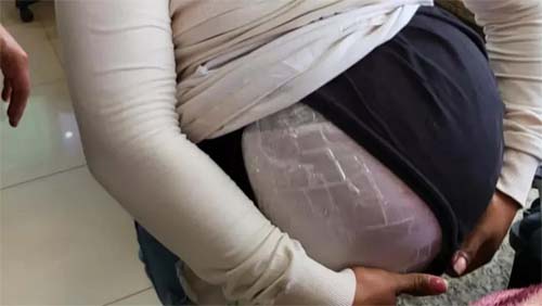 ‘Falsa grávida’ tenta entrar no Brasil com 6kg de sementes de maconha na barriga