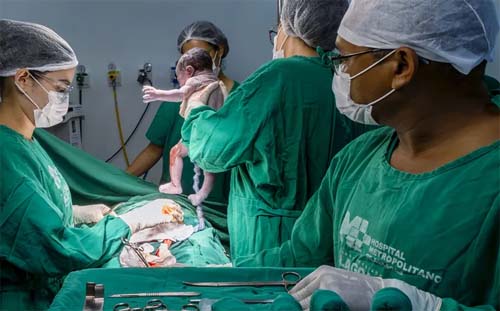 Alagoas registra aumento na taxa de cesarianas e redução nos partos naturais