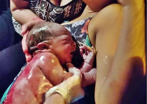 Mulher dá à luz dentro de um carro na AL 101 com auxílio do BPRv