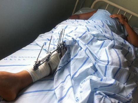 Acusado de atropelar gari natural de União dos Palmares foi transferido para o sistema prisional