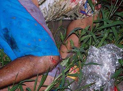 IML registra 13 vítimas de violência e oito de acidente