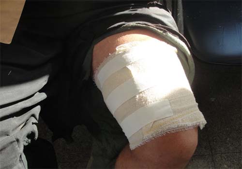 Sargento da PM foi baleado durante uma tentativa de assalto. 