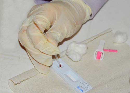 Departamento Estadual de Saúde reforça diretrizes de prevenção do HIV