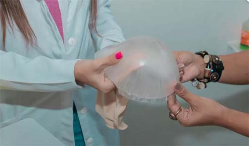 Saúde oferta prótese mamária externa a mulheres mastectomizadas