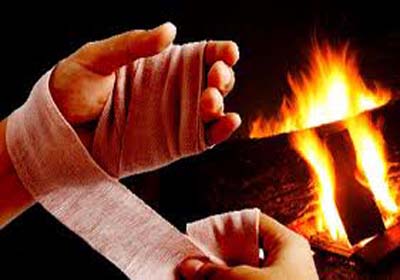 Acidentes com queimaduras atingem um milhão de pessoas por ano