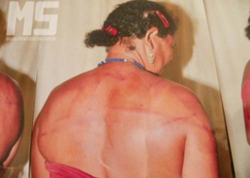 Mulher diz que é espancada pelo enteado há mais de 16 anos e polícia é omissa em Canapi 