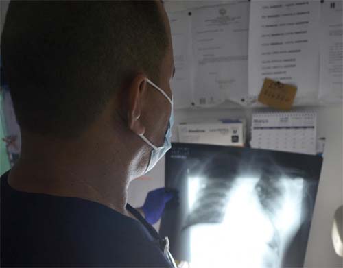 Dia Mundial de Combate à Tuberculose: doença pode atingir outros órgãos além do pulmão