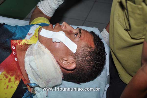 Auxiliar de mecânico é vitima de atentado a bala na periferia de União