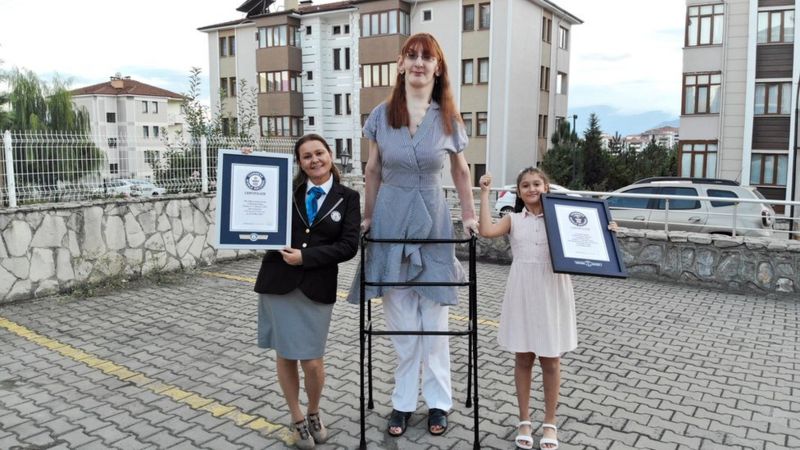 Rumeysa Gelgi, a mulher mais alta do mundo: o que é a síndrome de Weaver, que a deixou tão alta