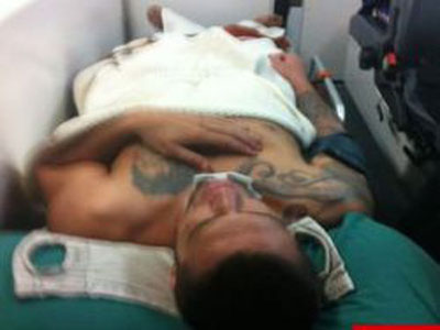 Ex-lutador do TUF quebra pênis em relação sexual