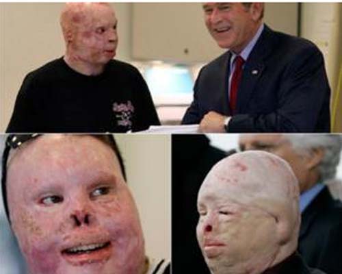 Dez anos da invasão do Iraque - Os horrores que ninguém mostra 