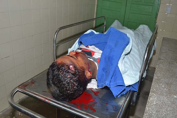 Adolescente de apenas quinze anos é morto a tiros em Joaquim Gomes