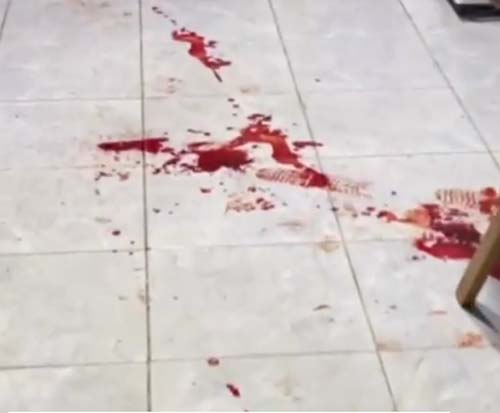 Gravida é baleada durante suposta troca de tiros entre facções criminosas