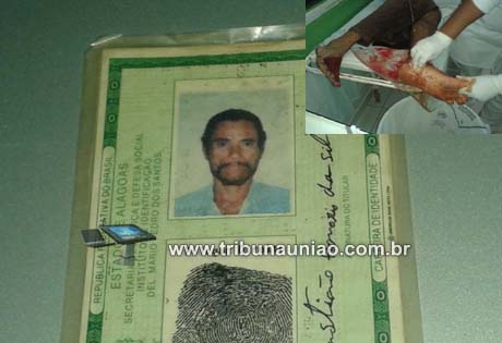 Homem é atingido por tiro no pé na zona rural de Santana do Mundaú