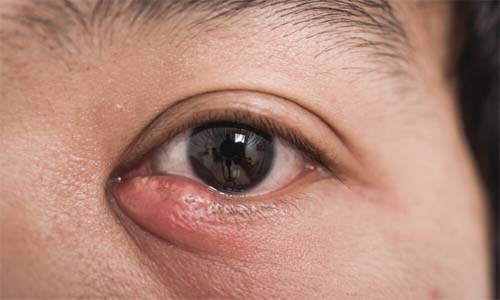 Não estão lá à toa! 3 secreções corporais nojentas que protegem nosso corpo