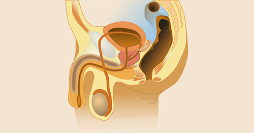Infecções virais podem afetar o sistema reprodutor masculino