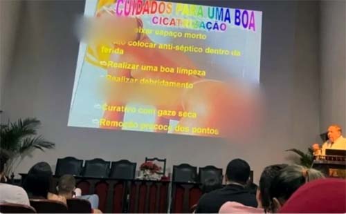 Médico usa foto de mulher nua em slide durante curso de emergência clínico-cirúrgica em Maceió