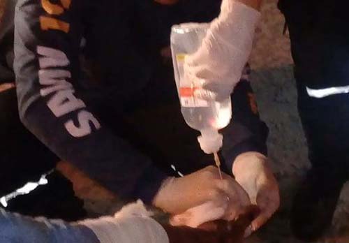 Duas tentativas de homicídio são registradas nas últimas 24h na Grande Maceió