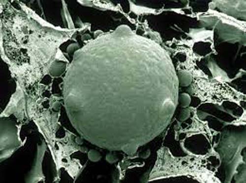 Infecções por superfungos devem se tornar mais comuns, diz pesquisador