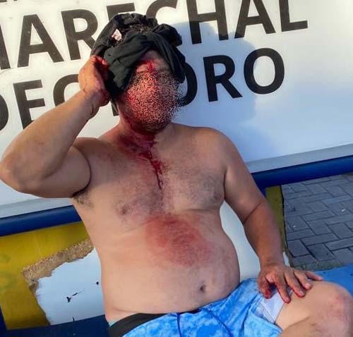 Homem sofre tentativa de Latrocínio (roubo seguido de morte) na Rua dos Cajueiros em Marechal Deodoro.  