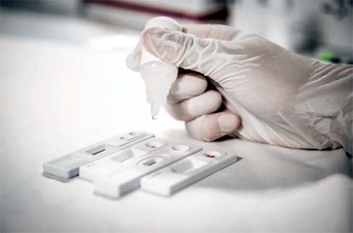 Saúde realiza testagem rápida para as hepatites virais