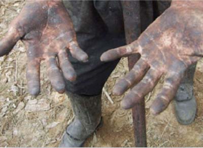 90 trabalhadores são flagrados em trabalho escravo em AL, 117 alagoanos foram flagrados em outros estados