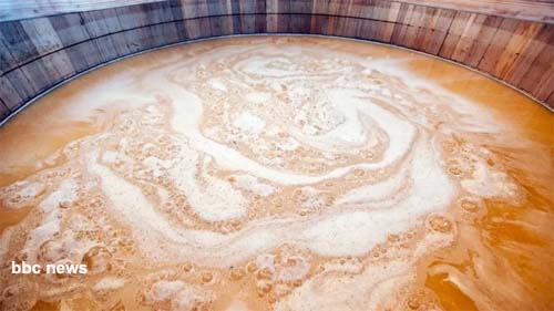 A misteriosa síndrome que deixa pessoas bêbadas com álcool produzido no próprio estômago