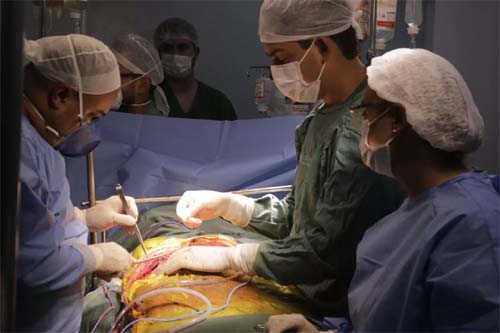 Serviço de transplante de fígado em AL é retomado no hospital Coração Alagoano