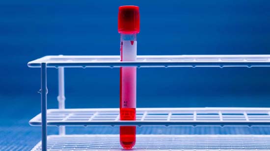 Câncer é sintoma do sucesso da humanidade, afirma Siddhartha Mukherjee