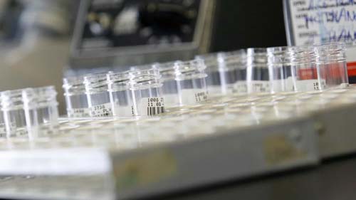 Cientistas chineses testam vacina contra a aids em seres humanos