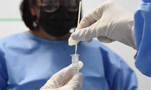 Nova variante da covid-19 é detectada no Rio de Janeiro e representa 62% dos casos analisados