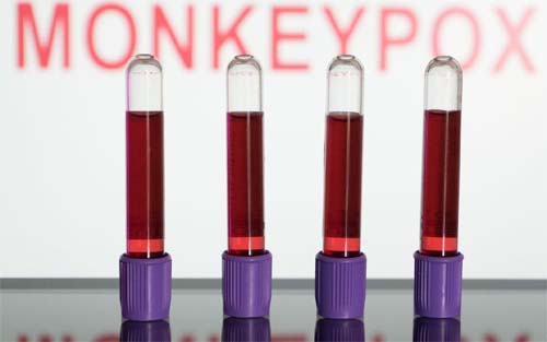 Infectologista prevê aumento de casos de monkeypox em AL: 