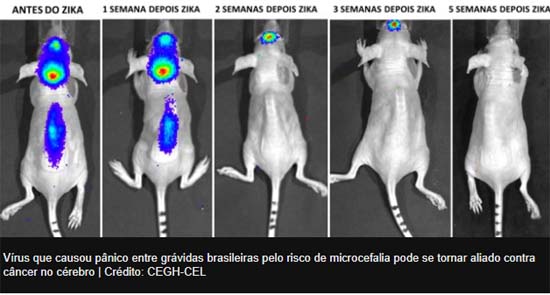 Vírus da Zika pode dar origem a tratamento para tumores de cérebro, apontam estudos da USP