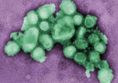 Sesau confirma dois casos de gripe H1N1 em Alagoas