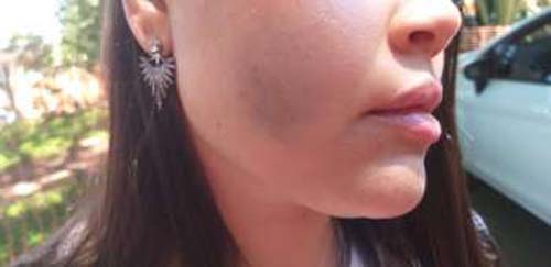 MP pede prisão preventiva de acusado de espancar esposa