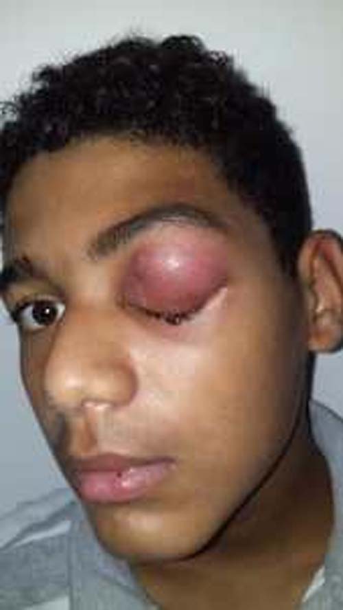 Família denuncia Hospital de Teotônio Vilela por negligência médica após 15 dias de sofrimento de jovem